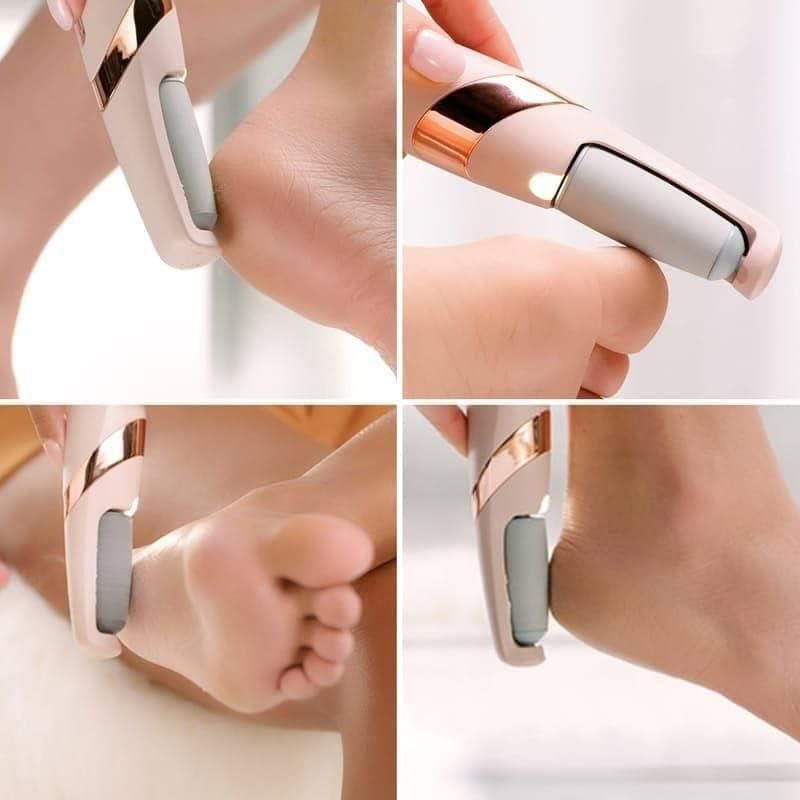 Rechargeable Electric Foot Callus Remover – Dead Skin Remover Machine for Women & Men
